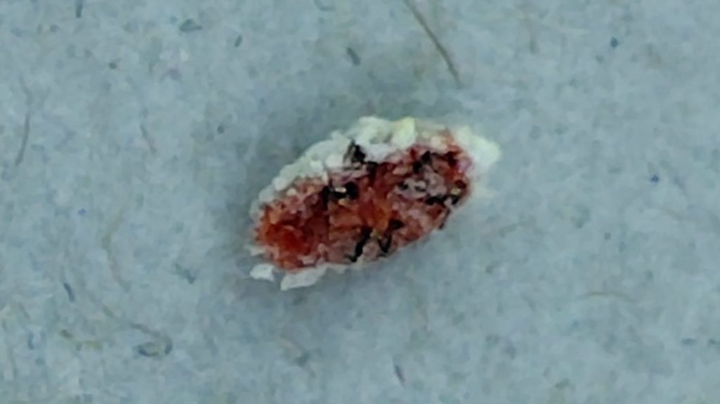 スプレー後のカイガラムシの様子